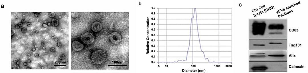 我国学者最新研究表明:外泌体mirna或将更适合结肠癌早期诊断