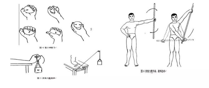 常见的骨科康复功能锻炼方法,建议收藏!