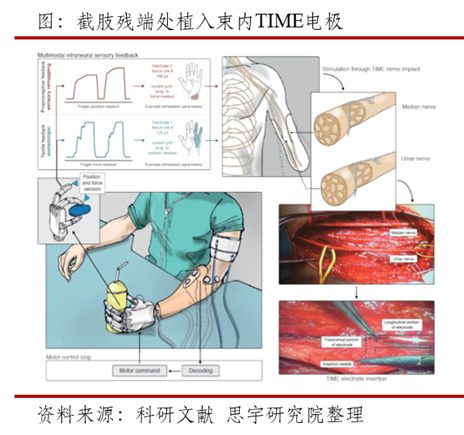 行研丨上肢型假肢酷酷的漫威冬兵離我們有多遠技術篇