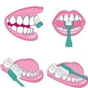 齿生科普：正确刷牙真的很重要，你会刷牙吗？