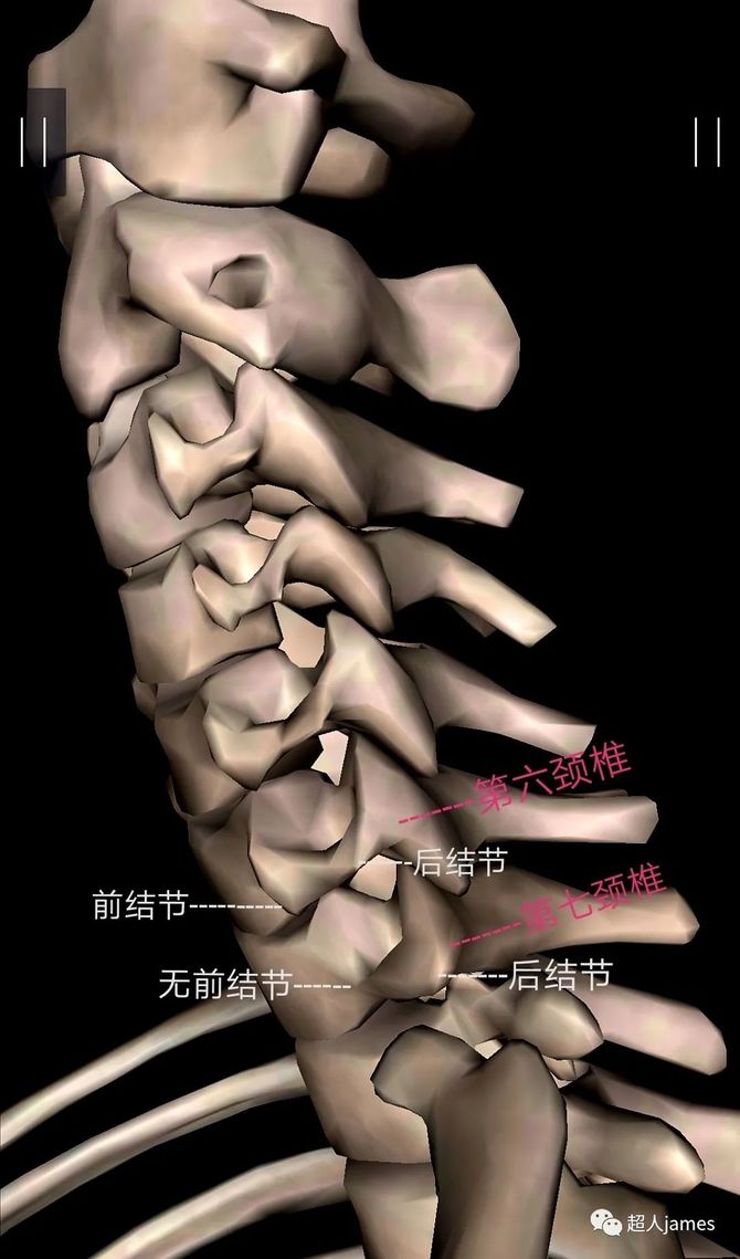 頸椎及神經根的識別和定位