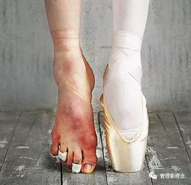 华为30年是凭着一双烂脚走过来的