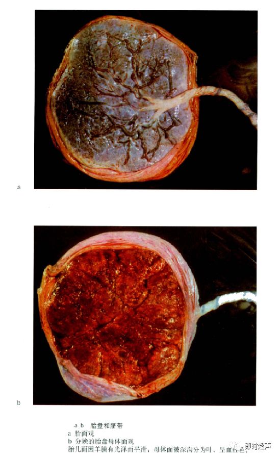 胎盘母体面图片