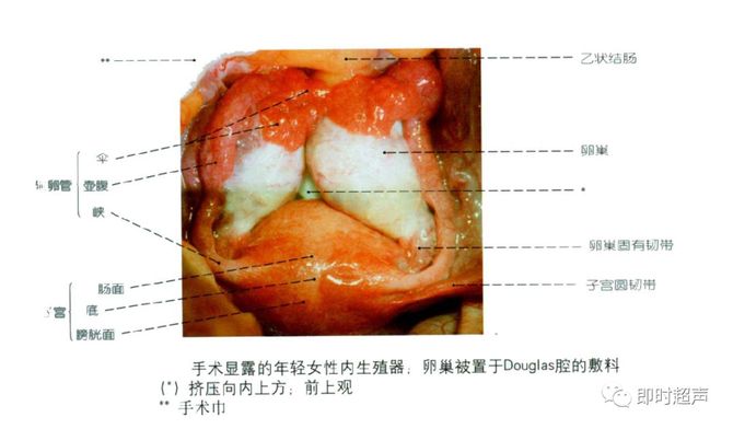 射精管:輸精管壺腹與精囊腺排洩管匯合成射