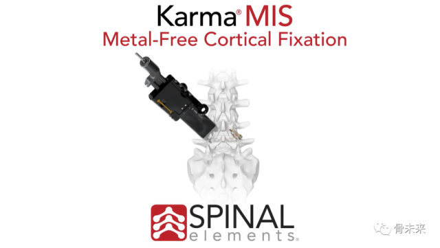 脊柱械企Spinal Elements：新型无金属固定系统