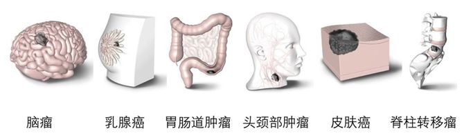 思宇研究院, 什么？眼科巨头蔡司也开始做放疗了！