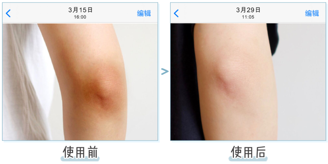 jcleaninc搓澡刷采用了3d嵌入毛孔结构,一次就"掏空毛囊油污垃圾"