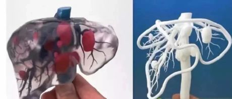 医学3D打印机的重大发现“仿生胰腺”