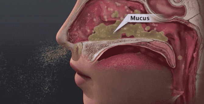 新知达人, 顽固的鼻炎这个方子试试!除涕止喷嚏,通鼻抗敏!