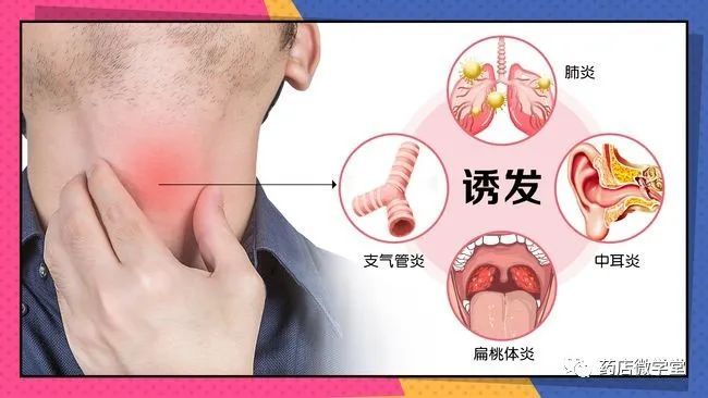 急慢性咽炎如何的区分与联合用药