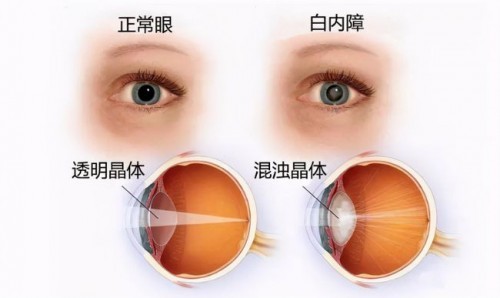 虽然一白遮百丑眼睛还是黑起安逸