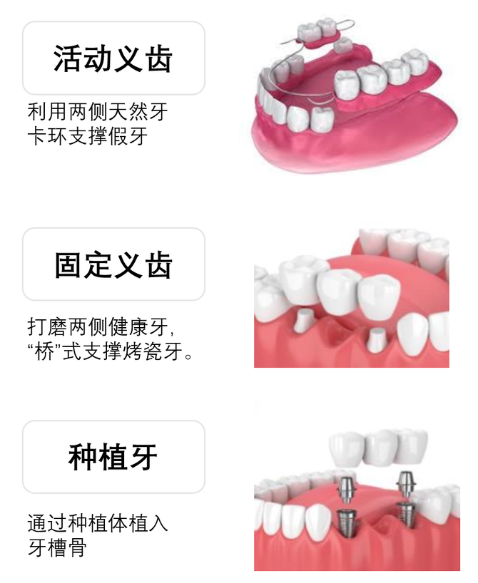 瞪羚社, 先拉葛兰、张坤一把！无惧“集采”的牙茅，到击球区了？