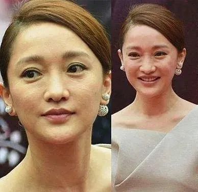 见微评论, 46岁周迅生图曝光,网友直呼被骗得好惨:"冻龄美人"99%都是