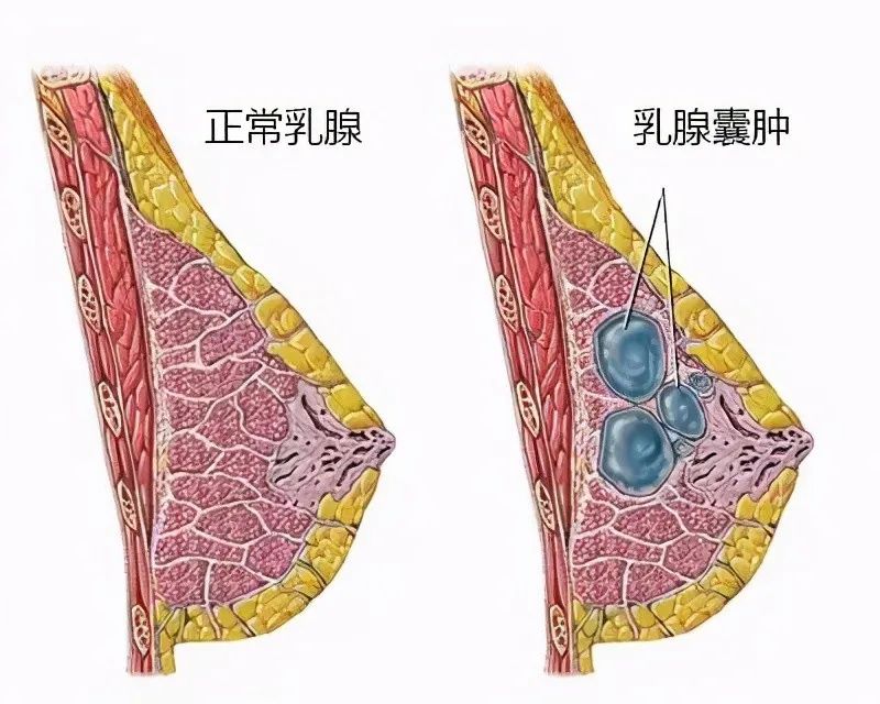 乳腺分区图解A区B区图片