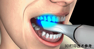 新知达人, 3D打印在口腔种植领域的应用效果如何？