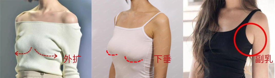 乳房位置低图片