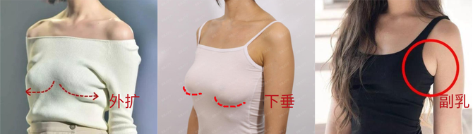 胸部没有支撑,在地心引力的作用下,很快就会下垂,外扩,胸型越来越难看