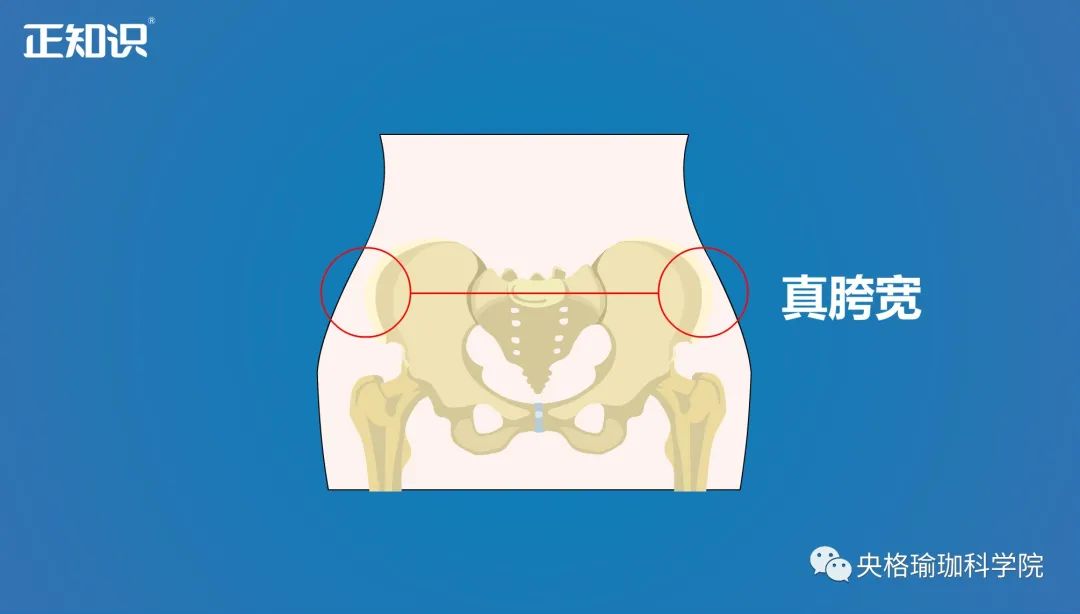 髂嵴最高点平对图片