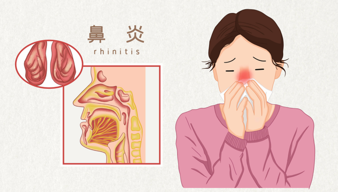 药店微学堂, 过敏性鼻炎联合用药方案