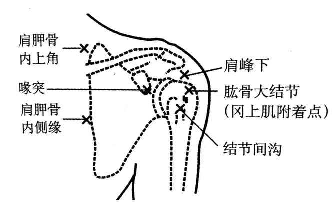 新知达人, 肩周炎相关解剖、评估和治疗