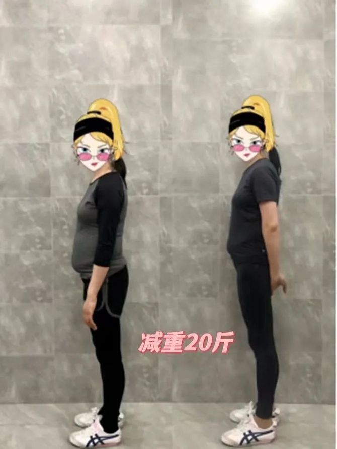 keep网红暴瘦30斤真相曝光不节食不运动这才是最牛的整容